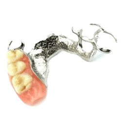 Metal Framed Denture